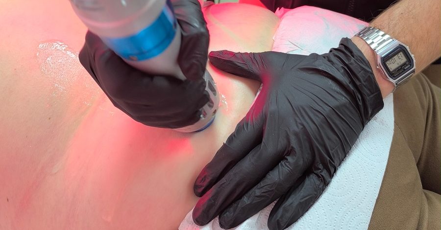 Diatermia radiofrecuencia Fisiobriut